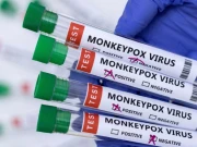 کراچی میں منکی پاکس کا ایک اور مشتبہ مریض سامنے آگیا