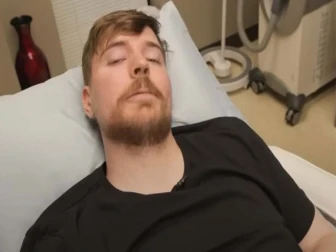 مسٹر بیسٹ کی دائیں آنکھ کی بینائی تقریباً ختم ہوگئی