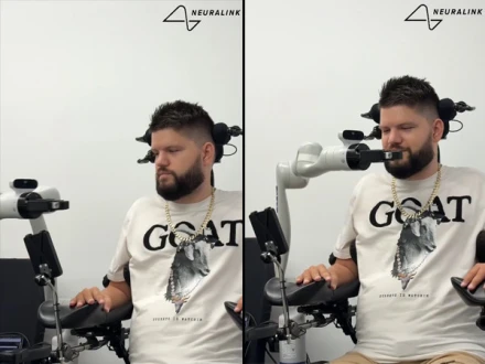 نیورا لِنک چپ لگوانے والے مفلوج افراد دماغ سے ڈیوائسز کنٹرول کرنے لگے!