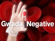 فرانسیسی سائنس دانوں نے خون کا 48 واں بلڈ گروپ دریافت کر لیا