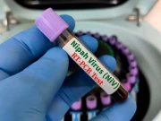 نپاہ وائرس: بھارت میں کیسز کے بعد ایشیائی ہوائی اڈوں پر ہائی الرٹ، مسافروں کی اسکریننگ سخت