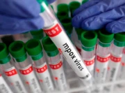 برطانیہ میں منکی پاکس کے دو مزید کیسز کی تصدیق