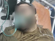 لاہور، رکشہ ڈرائیور کی جان بچانے والا پولیس اہلکار ٹرک کے ٹائر تلے آ کر شدید زخمی ہو گیا 