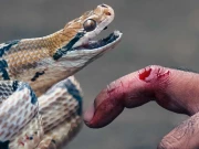 فلپائن میں مریضوں کو زہریلے سانپ سے کٹوا کر علاج کرنے والا طبیب 