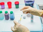 اے آئی ٹیک سے پیشاب کا تجزیہ پھیپھڑوں کی بیماری کی تشخیص کے لیے کارگر