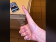 غیر معمولی لمبے انگوٹھے والا نوجوان موبائل کیسے استعمال کرتا ہے؟