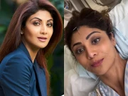 شلپا شیٹی چہرے پر سوئیاں لگوا کر کونسا ٹریٹمنٹ کرواتی ہیں؟ تصویر وائرل 