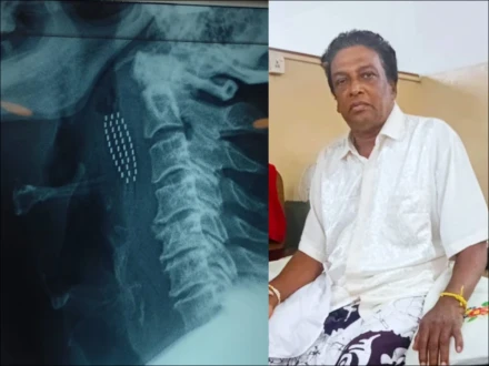 دانتوں کی صفائی نے موت کے منہ تک پہنچا دیا