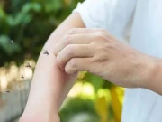 کچھ لوگوں کو مچھر دوسروں کے مقابلے میں زیادہ کیوں کاٹتے ہیں؟