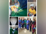 سول اسپتال کراچی میں سماعت سے محروم  بچے کا کامیاب آپریشن کرکے کوکلئیر امپلانٹ نصب کردیا گیا