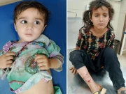 کراچی: آوارہ کتوں کے حملے میں 2 کمسن بہنیں زخمی