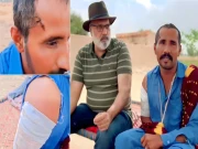 بہاولپور: صحرائے چولستان میں جنگلی بلی کے حملے میں چرواہا زخمی