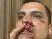 لاہور:  آسٹریلوی نژاد پاکستانی پر پولیس کا تشدد، مقدمہ درج، اہلکار گرفتار