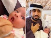 شارجہ میں 6 دن کی بچی کے دانت نکل آئے، ڈاکٹر حیران