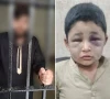 راولپنڈی: سوتے ہوئے بستر پر پیشاب نکلنے پر 10 سالہ گھریلو ملازم پر بدترین تشدد، مالک گرفتار