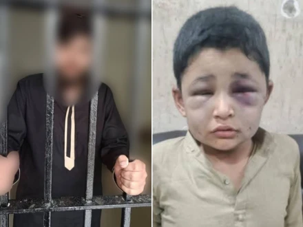 راولپنڈی: سوتے ہوئے بستر پر پیشاب نکلنے پر 10 سالہ گھریلو ملازم پر بدترین تشدد، مالک گرفتار