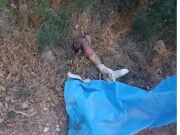 اسلام آباد: تھانہ کراچی کمپنی کے ایریا میں کٹی ہوئی انسانی ٹانگ برآمد