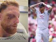 چہرے پر سنگین چوٹ لگنے کے بعد زندہ بچ جانا میری خوش قسمتی ہے، بین اسٹوکس