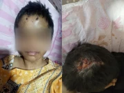 لاہور میں ڈاکٹر میاں بیوی کا 12 سالہ گھریلو ملازمہ پر بدترین تشدد