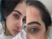 عرفی جاوید کی روتی ہوئی اور چہرے پر تشدد کے نشانات والی تصویر وائرل