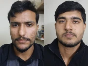  کینسر کا مریض بن کر امریکی ویزا حاصل کرنے کا خواہش مند اور سہولتکار گرفتار