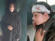 لاہور؛ دوران چیکنگ کار سوار خاتون نے تلخ کلامی پر لیڈی اہلکار کا بوتل سے سر پھاڑ دیا