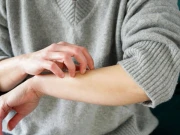 ہمیں کھُجلی کیوں ہوتی ہے؟