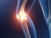 جوڑوں کا درد ختم کردینے والا جیل تیار