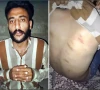 کراچی، نوجوان پر بہیمانہ تشدد، ایس ایس پی کا چوکی انچارج کو معطل کر کے انکوائری کا حکم