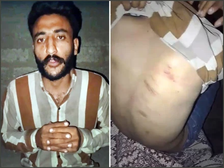 کراچی، نوجوان پر بہیمانہ تشدد، ایس ایس پی کا چوکی انچارج کو معطل کر کے انکوائری کا حکم