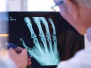 اے آئی ٹیکنالوجی ٹوٹی ہوئی ہڈیوں کی تشخیص میں مددگار قرار