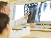 کینسر کے مریضوں میں بقا کی شرح بڑھ گئی